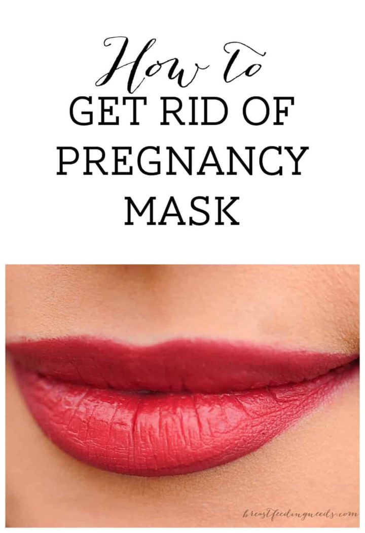 How to Get Rid of Pregnancy Mask Breastfeeding Needs
